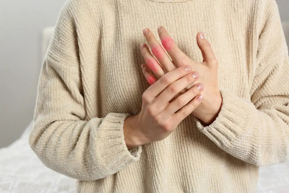Hands with reddened, painful knuckles held against a cream sweater